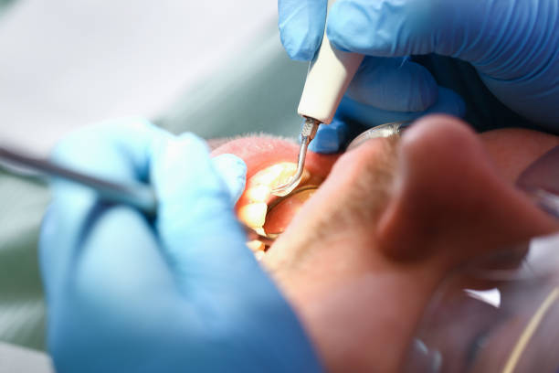 Best Mobile Emergency Dentist in Cherry Valley, CA