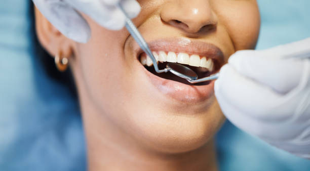 Best Emergency Dental Extractions in Cherry Valley, CA