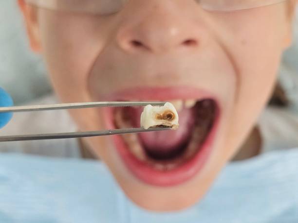 Best Orthodontic Emergency Dentist in Cherry Valley, CA